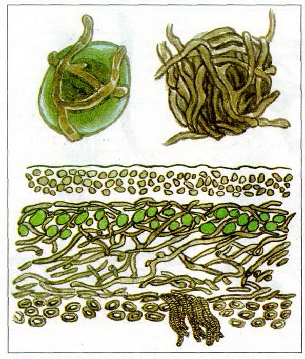 Взаимоотношения гриба и водоросли. Симбиоз гриба и водоросли в лишайнике. Строение лишайника под микроскопом. Строение симбиоз лишайников. Таллом лишайника под микроскопом.